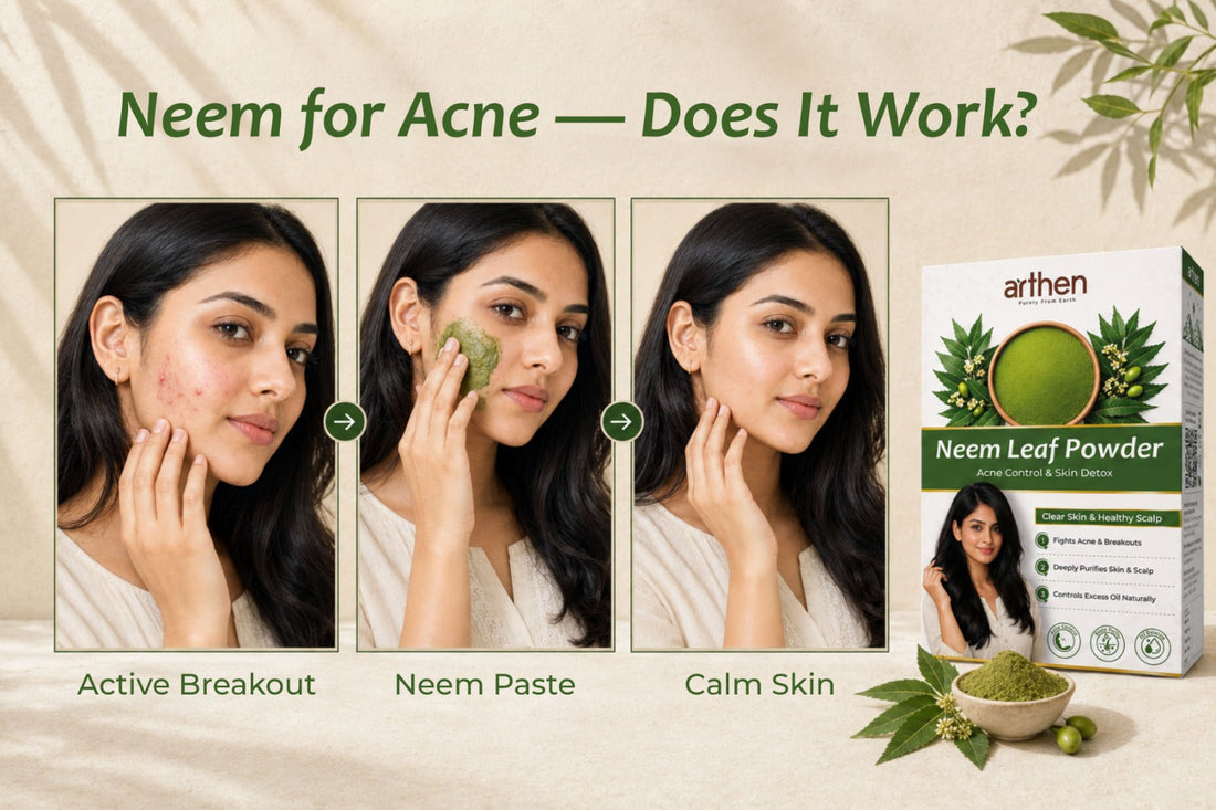 Neem leaf powder as natural acne treatment — how to use it for pimples