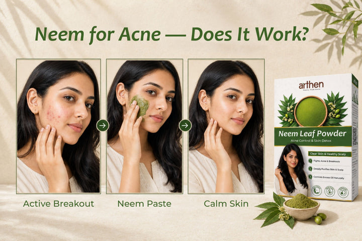 Neem leaf powder as natural acne treatment — how to use it for pimples