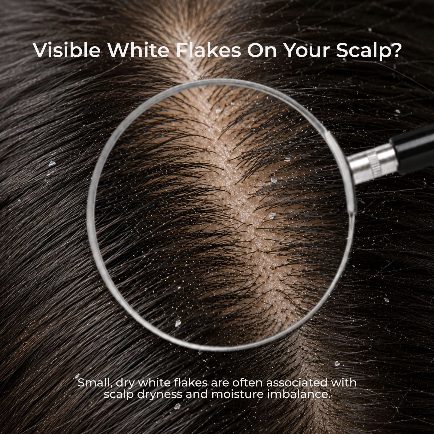 Dry scalp treatment at home — gentle herbal cleanser without stripping