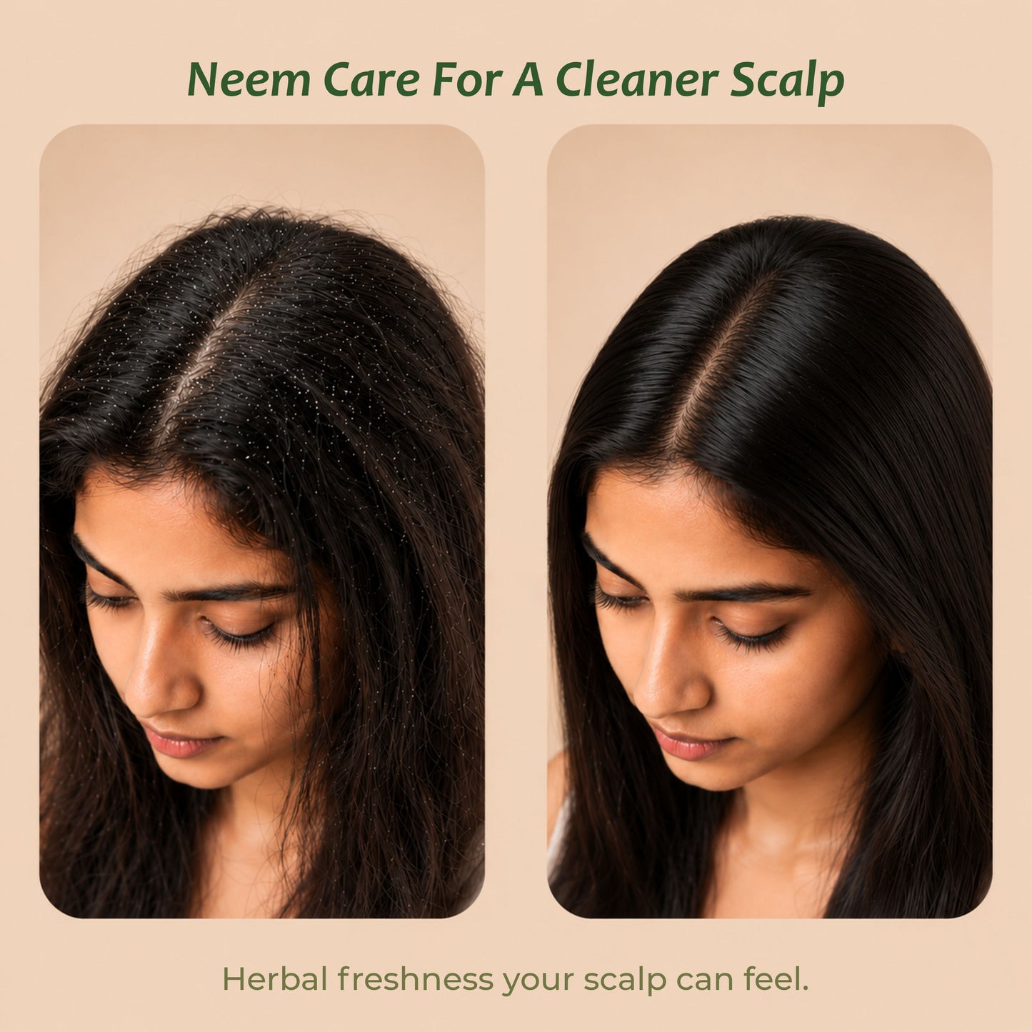 Neem powder for scalp — purifies and refreshes oily itchy scalp naturally
