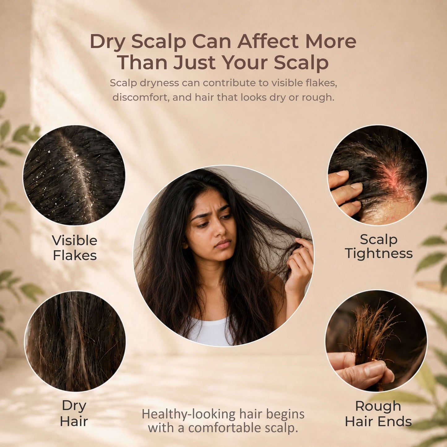 Dry scalp vs dandruff — herbal cleanser for dry sensitive scalp care