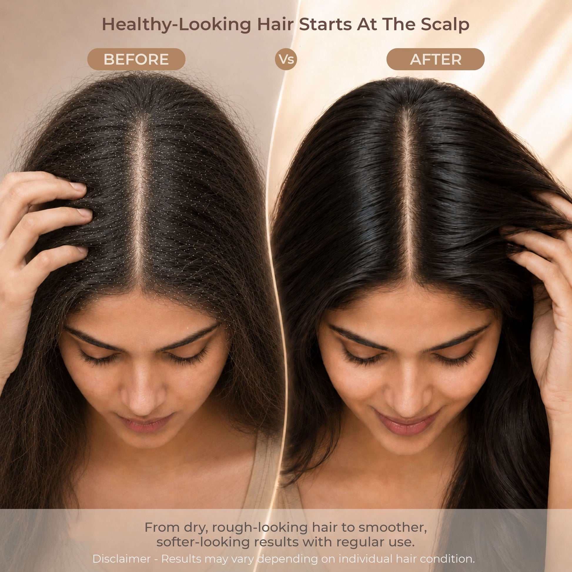 Sulphate-free hair wash for dry scalp — no SLS no chemicals